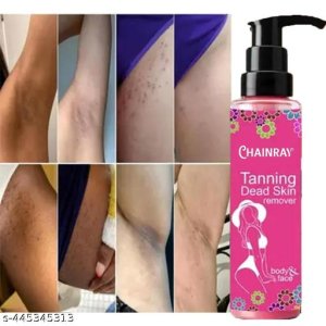 Trendy Blackhead Remover Cream
