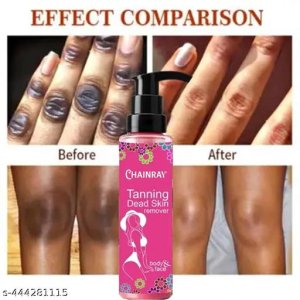 Trendy Dark Spot And Pimple Removing