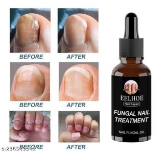 Premium Collection Remover